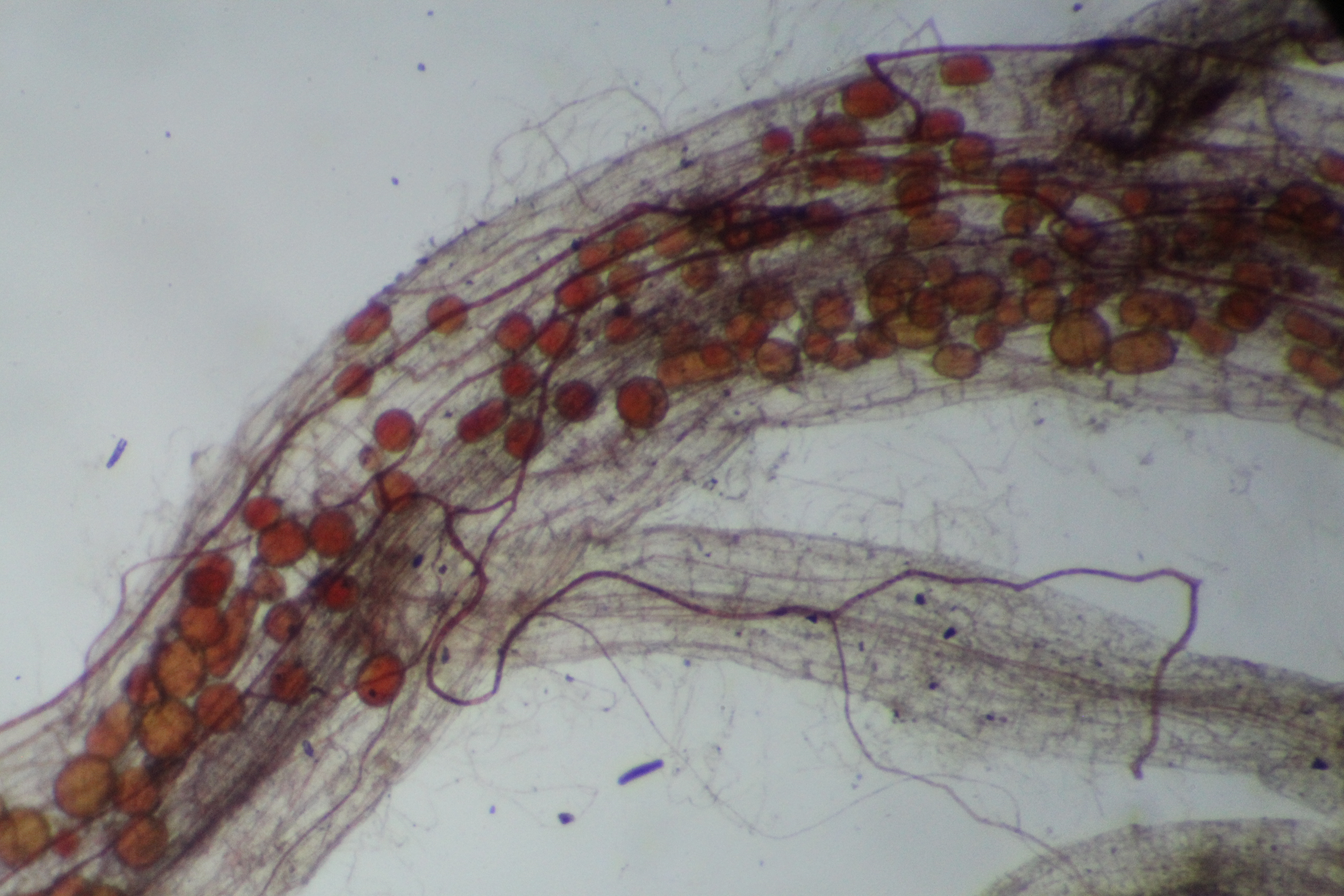 Symbiose zwischen Mykorrhiza-Pilzen und pflanzlichen Feinwurzeln. © INOQ GmbH